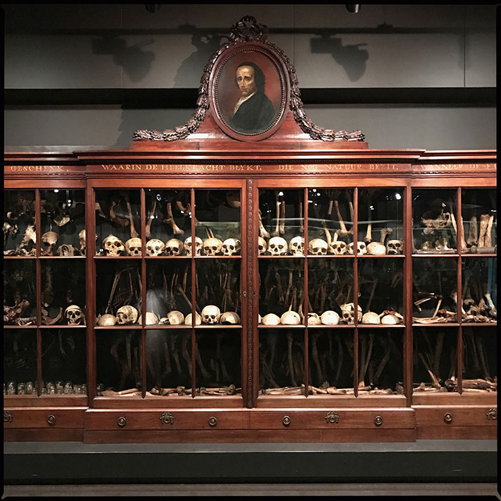 PMuseum Vrolik in Amsterdam